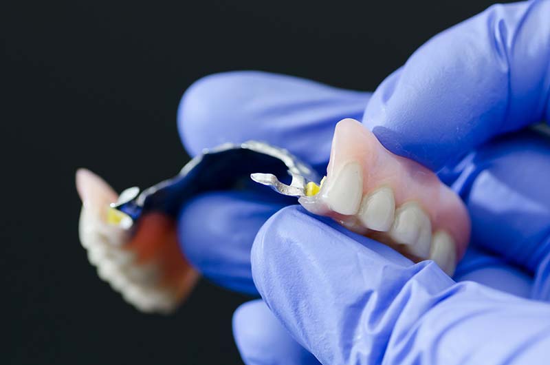 dentures prosthesis